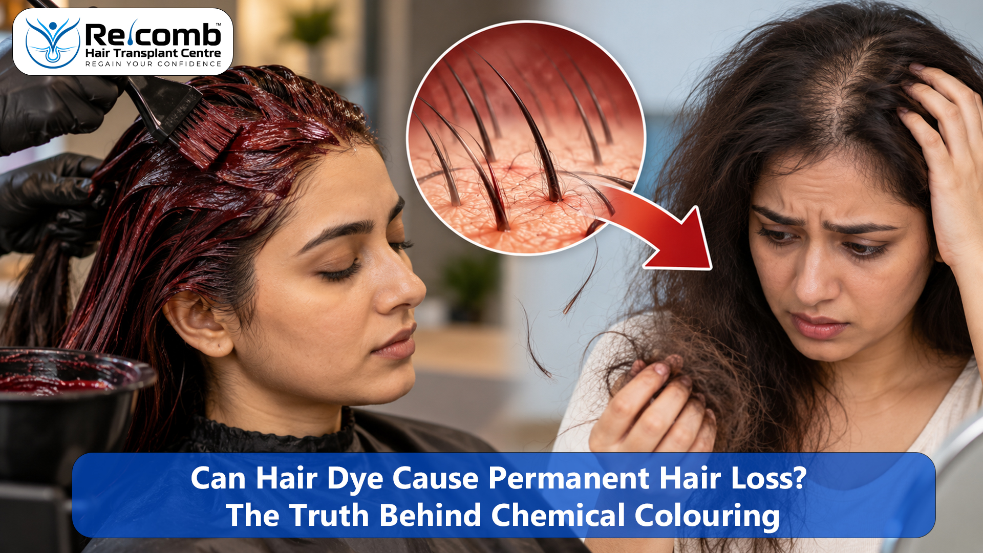 Can_Hair_Dye_Cause_Permanent_Hair_Loss_The_Truth_Behind_Chemical_Colouring