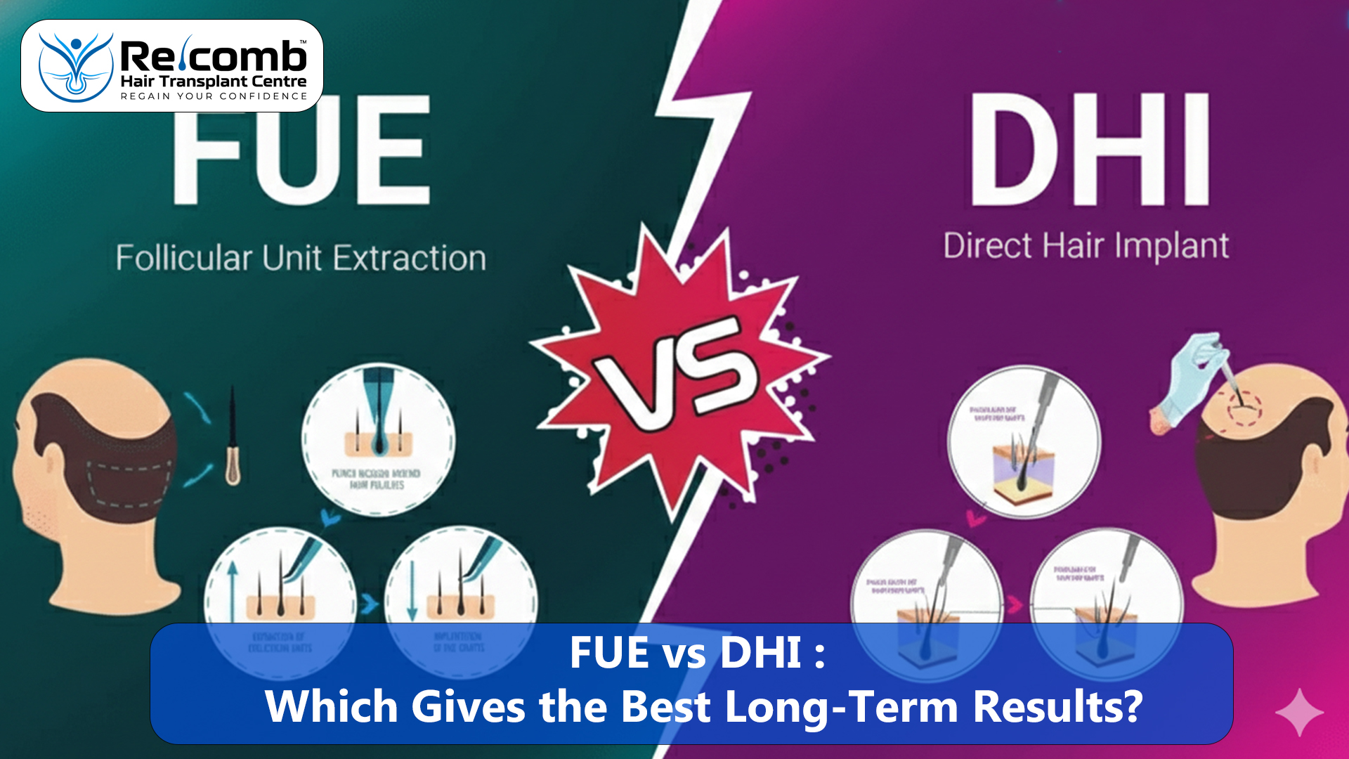 FUE_vs_DHI_Which_Gives_the_Best_Long_Term_Results