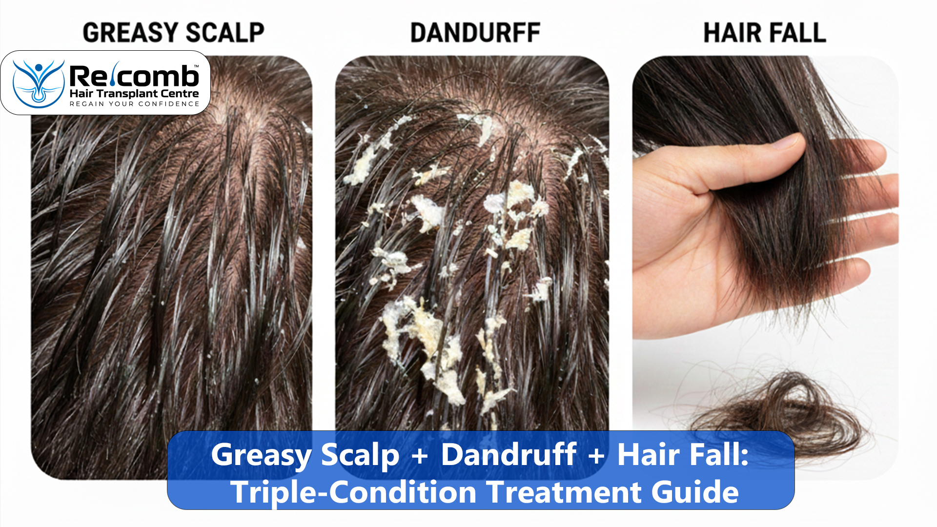 Greasy_Scalp___Dandruff___Hair_Fall_Triple_Condition_Treatment_Guide