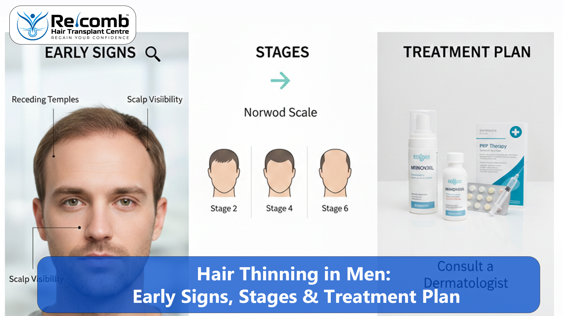 Hair_Thinning_in_Men_Early_Signs__Stages___Treatment_Plan_copy