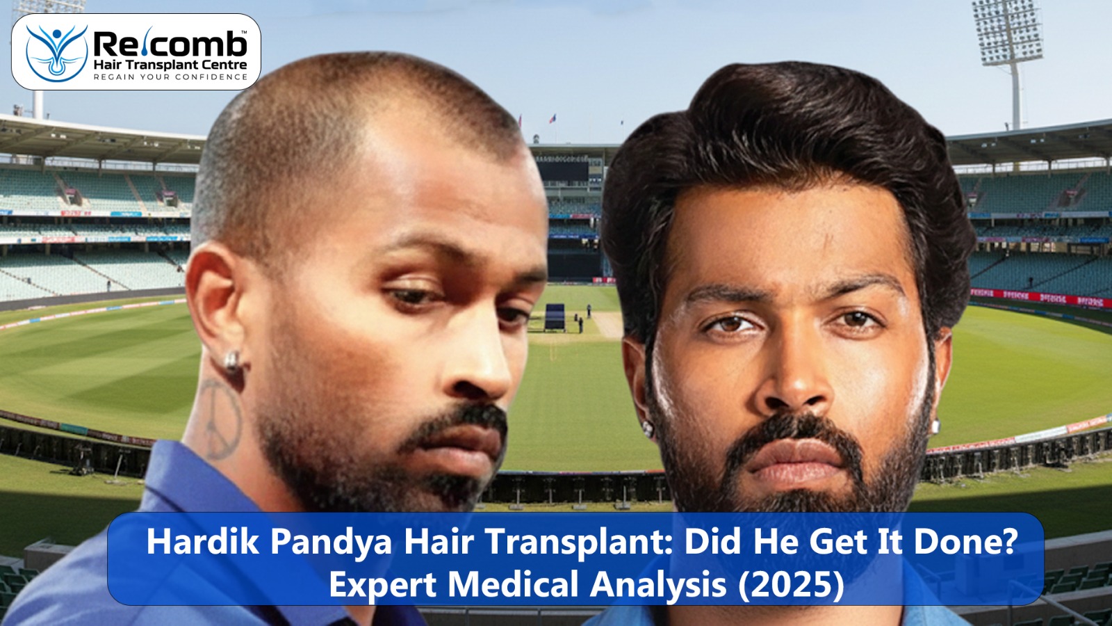 Hardik_Pandya_Hair_Transplant_Did_He_Get_It_Done_Expert_Medical_Analysis__2025_
