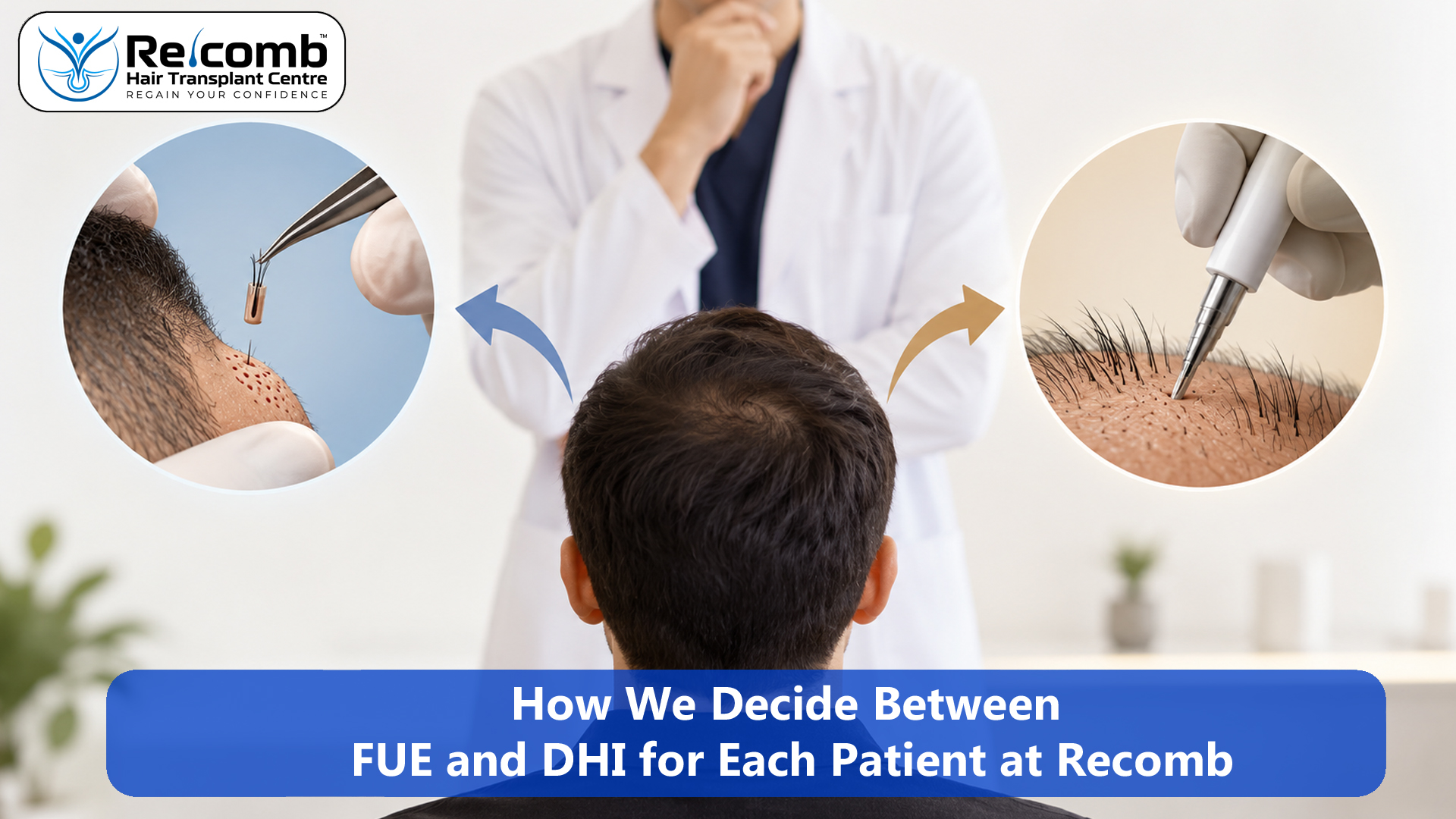 How_We_Decide_Between_FUE_and_DHI_for_Each_Patient_at_Recomb_ok_copy