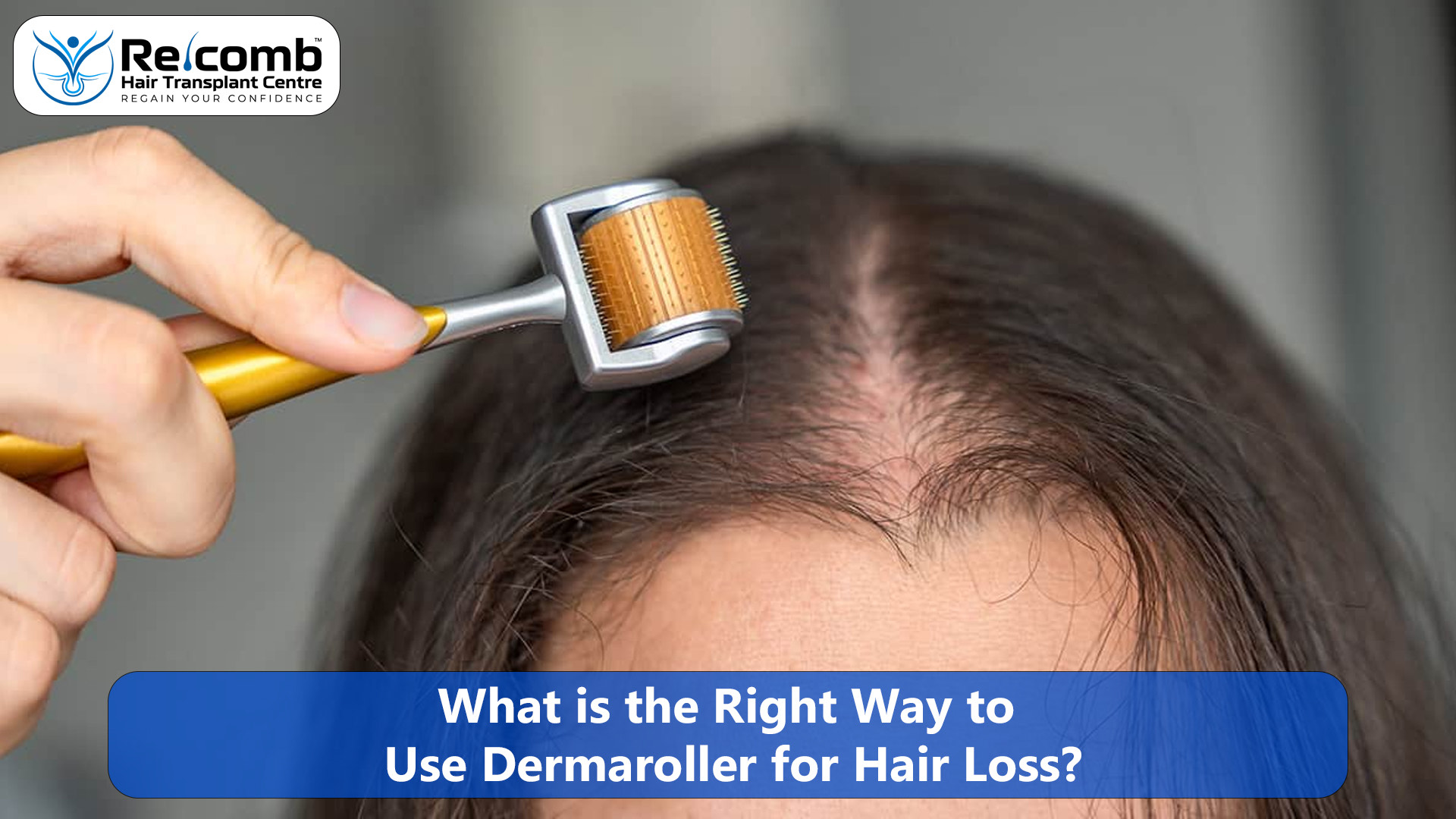 How_to_use_dermaroller_for_hair_loss