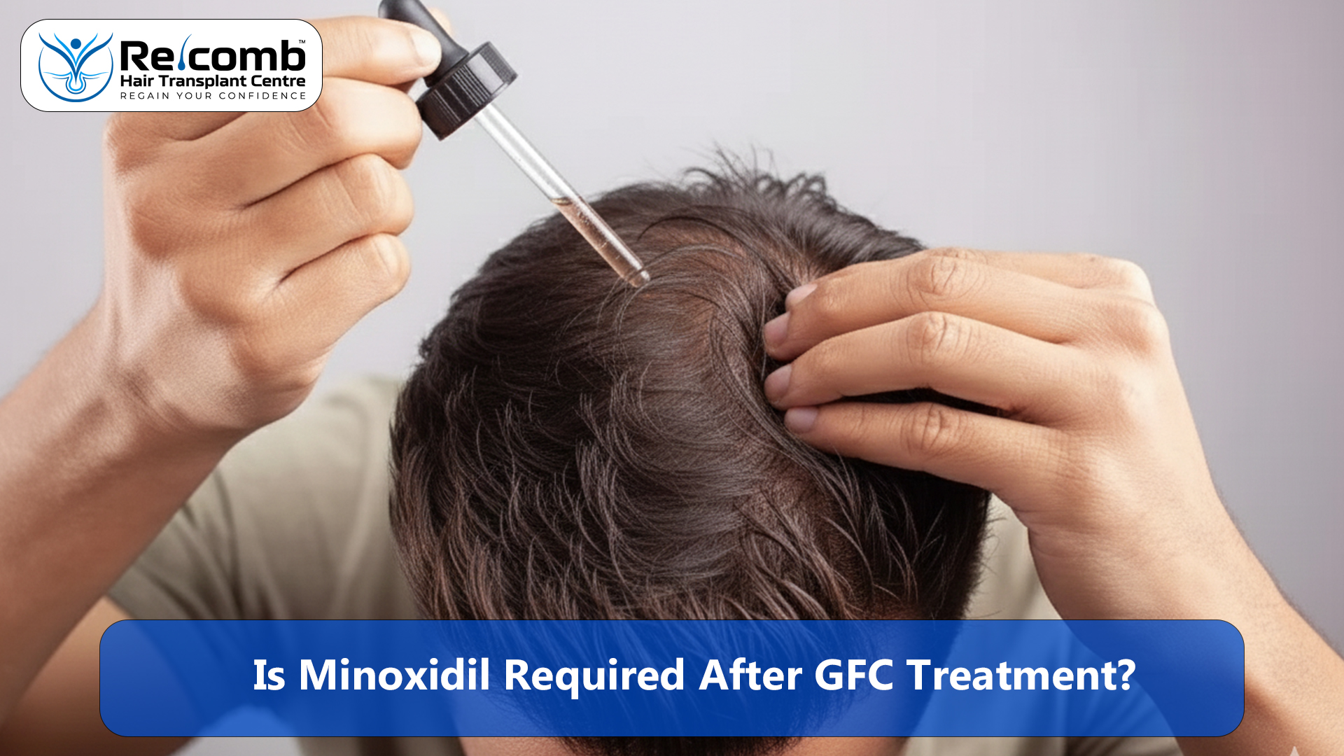 Is_Minoxidil_Required_After_GFC_Treatment