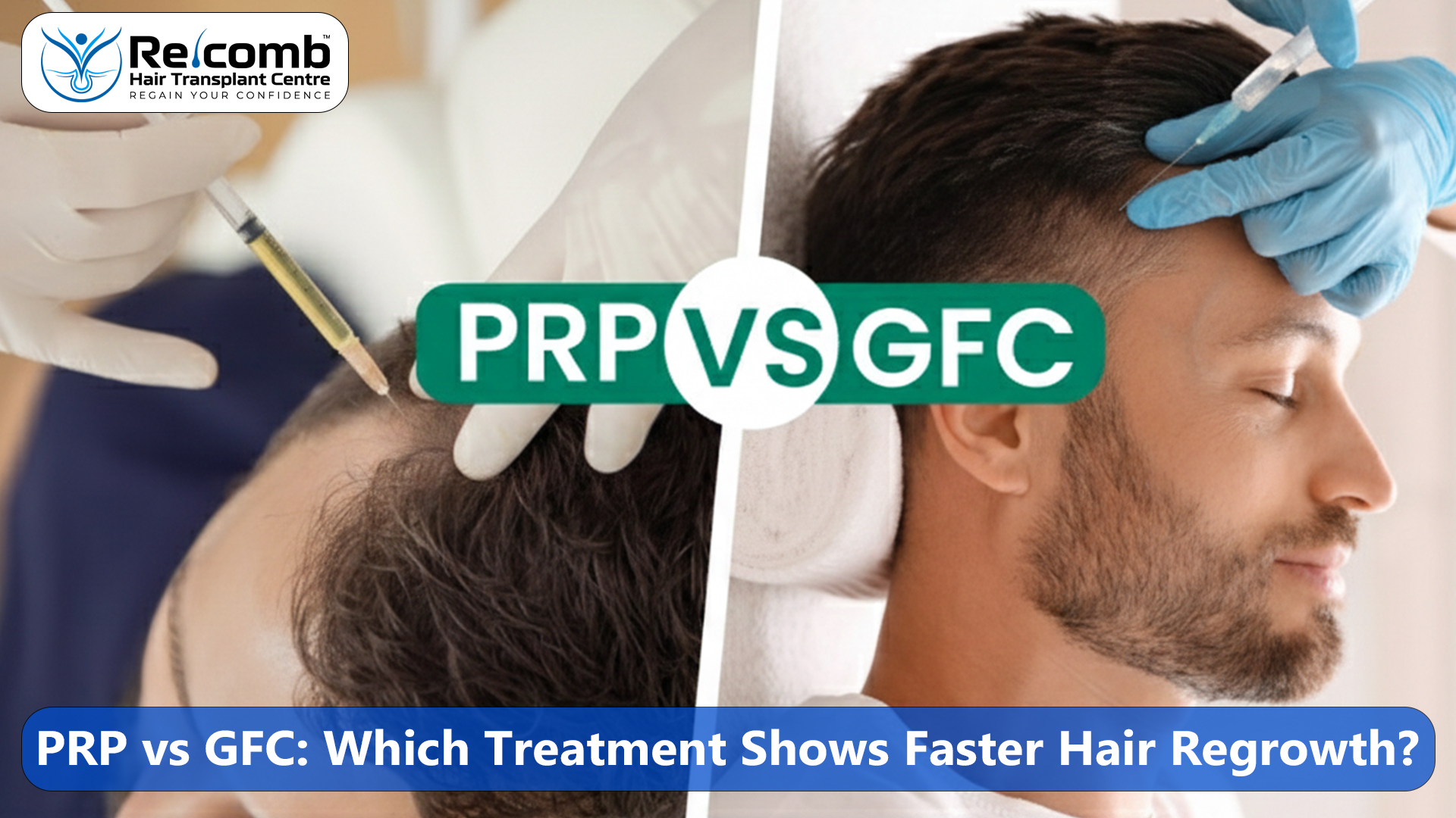 PRP_vs_GFC_Which_Treatment_Shows_Faster_Hair_Regrowth