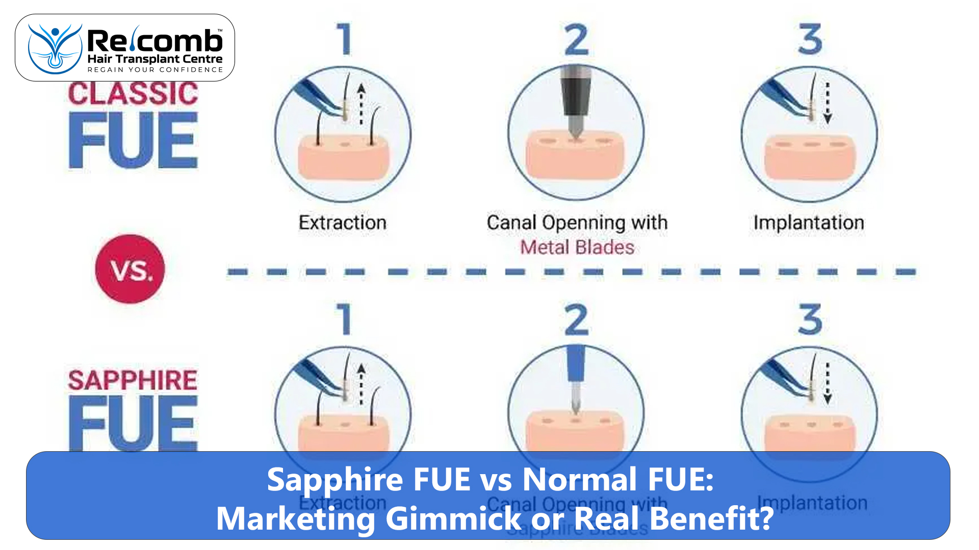 Sapphire_FUE_vs_Normal_FUE__Marketing_Gimmick_or_Real_Benefit