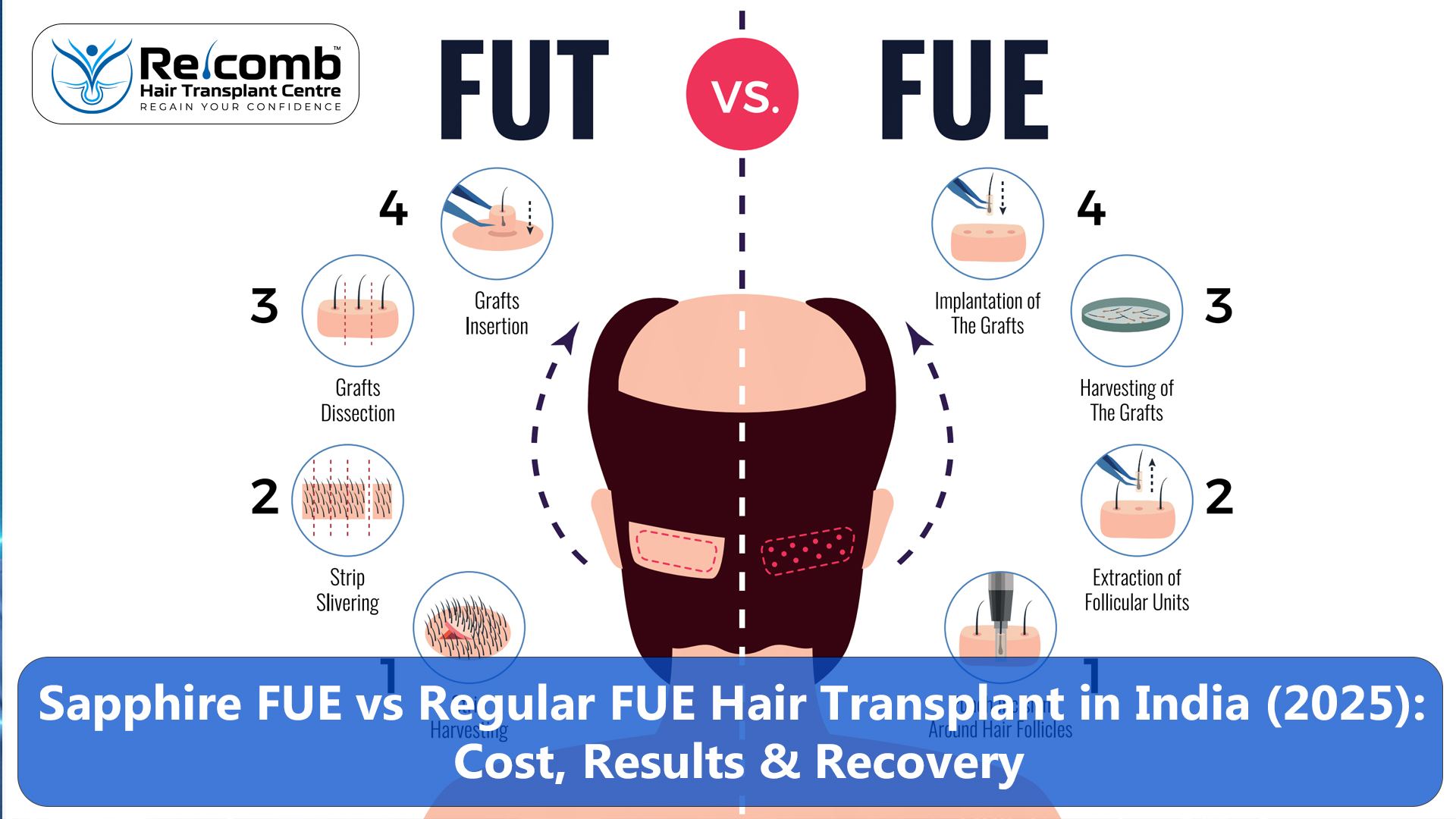 Sapphire_FUE_vs_Regular_FUE_Hair_Transplant_in_India__2025__Cost__Results___Recovery