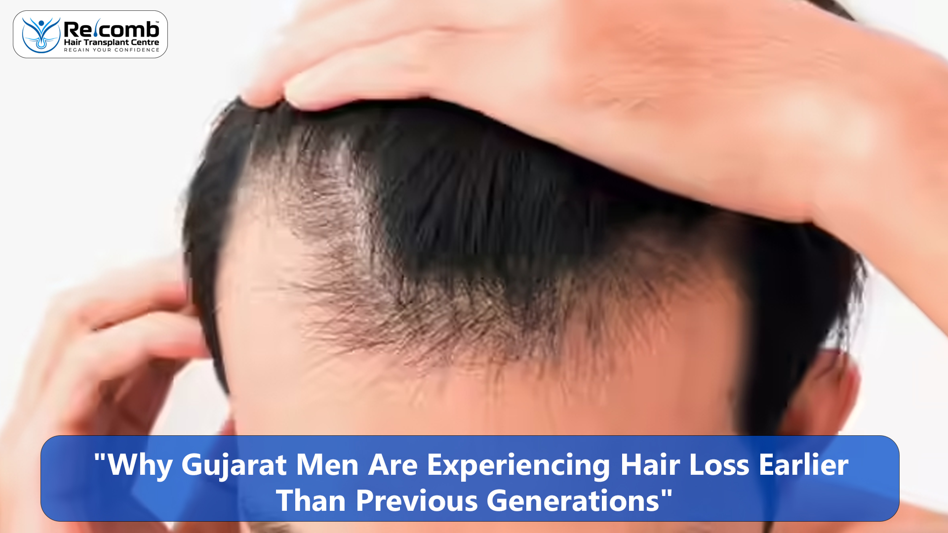 Why_Gujarat_Men_Are_Experiencing_Hair_Loss_Earlier_Than_Previous_Generations