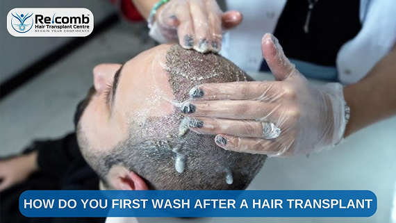 how_to_do_your_first_wash_after_a_hair_transplant