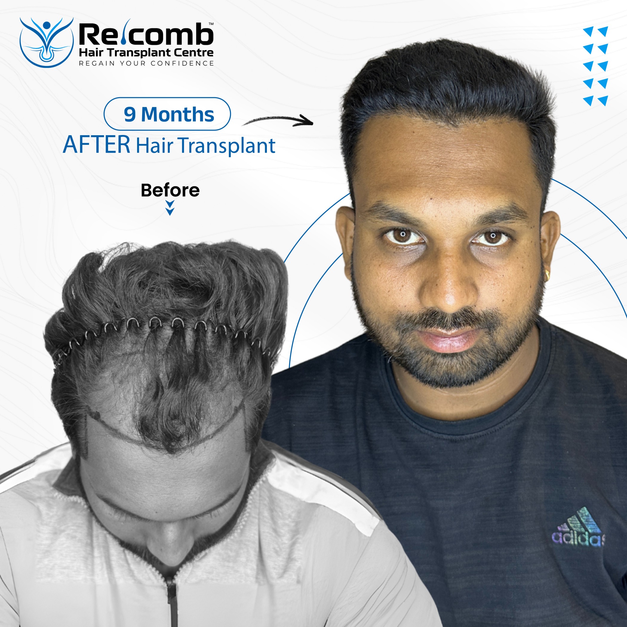 16_08_2024_Before_After_Post