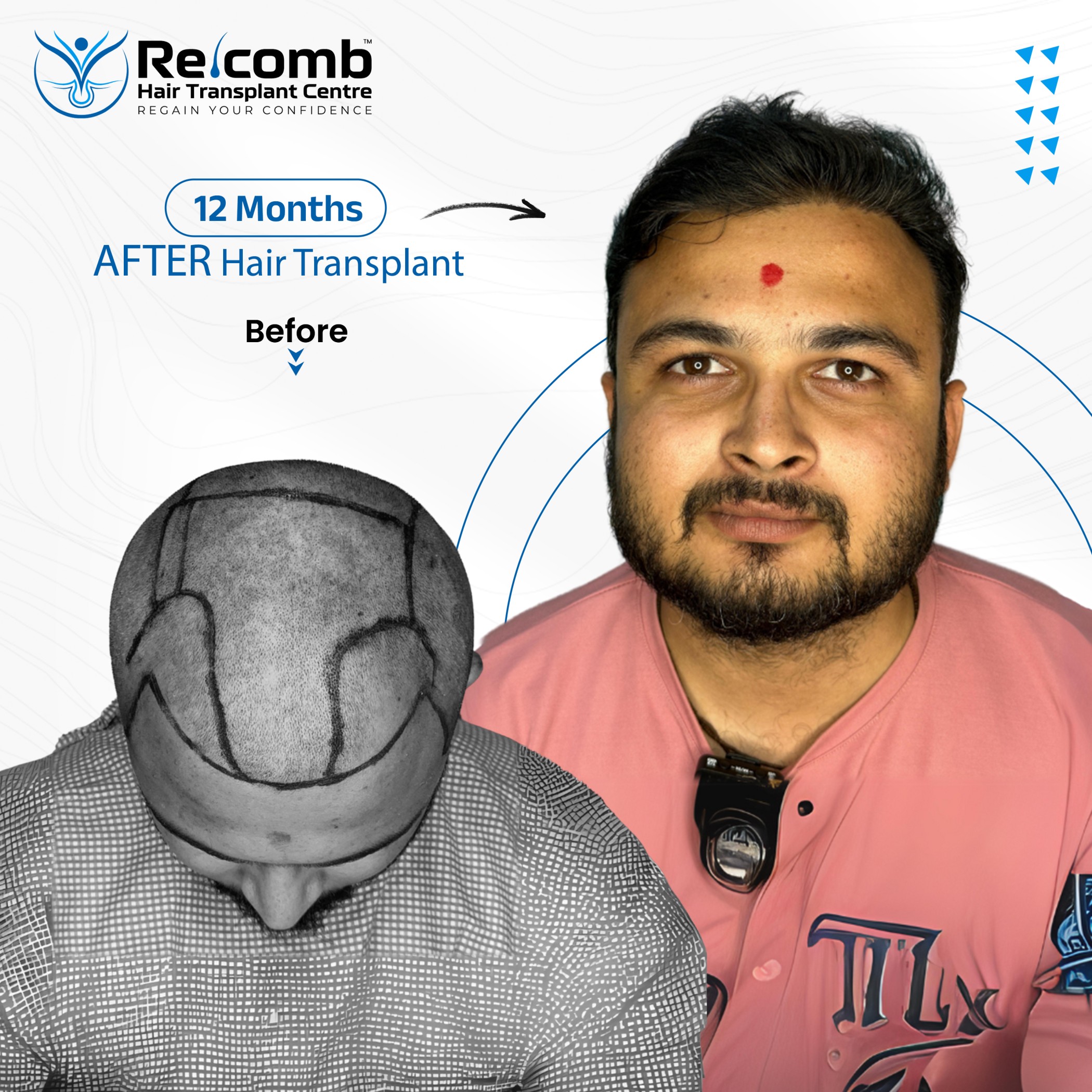 AbhishekBhai_Before_After_Post