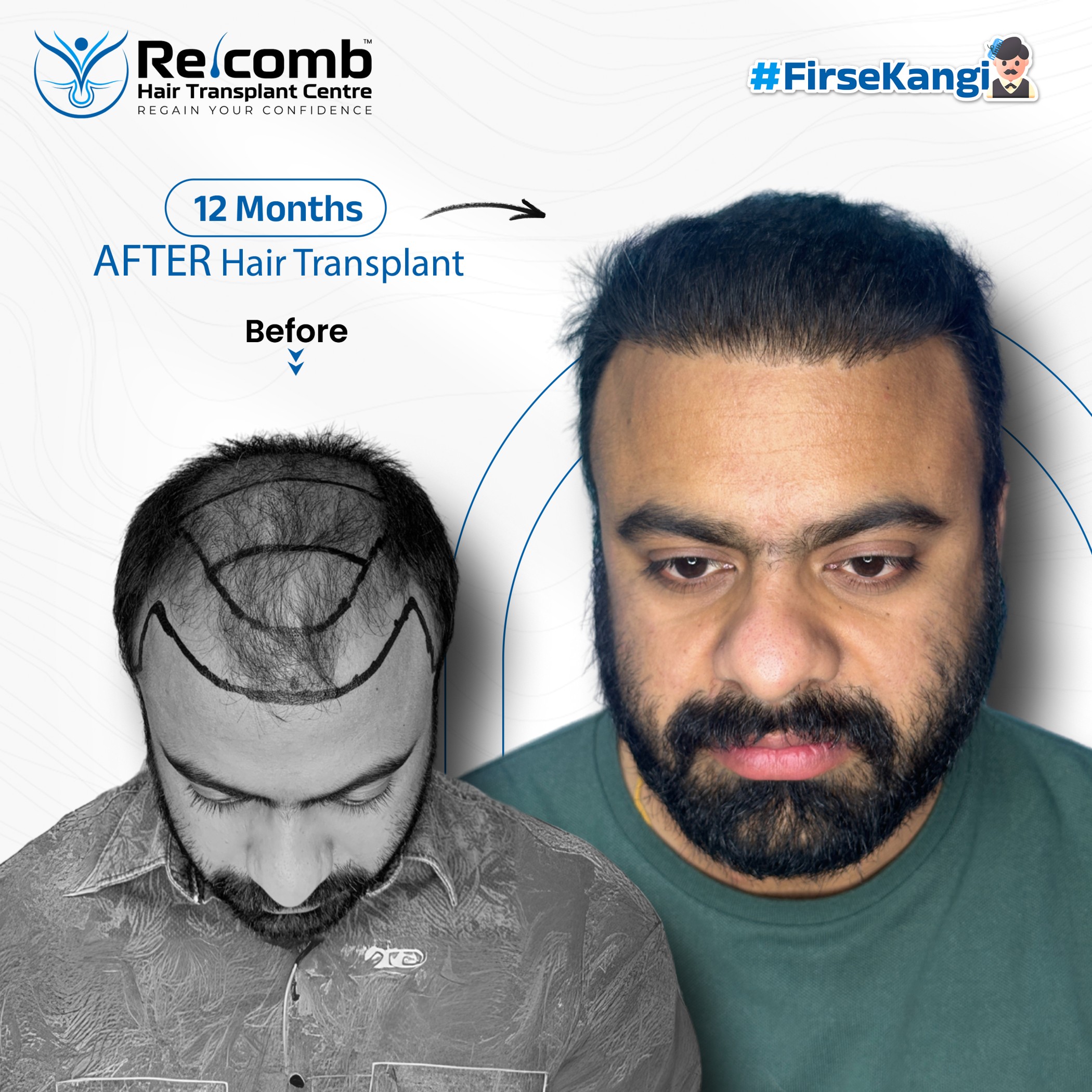 Bhavesh_Recomb_Before_After_Post