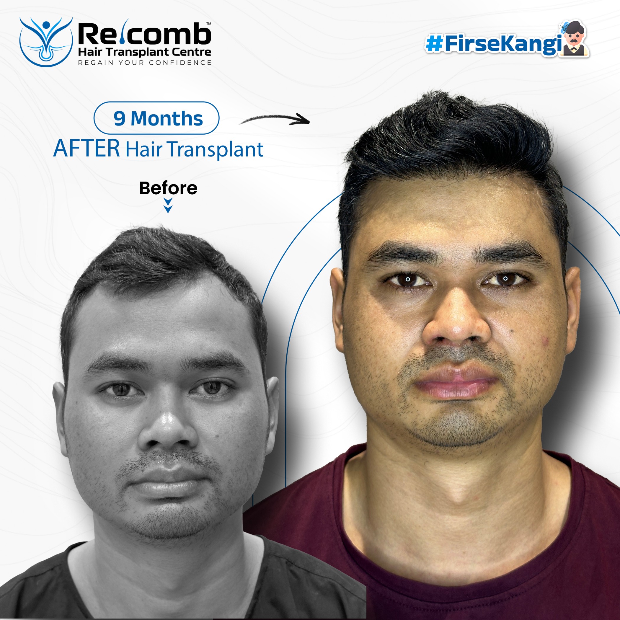 Dr_Recomb_Before_After_Post