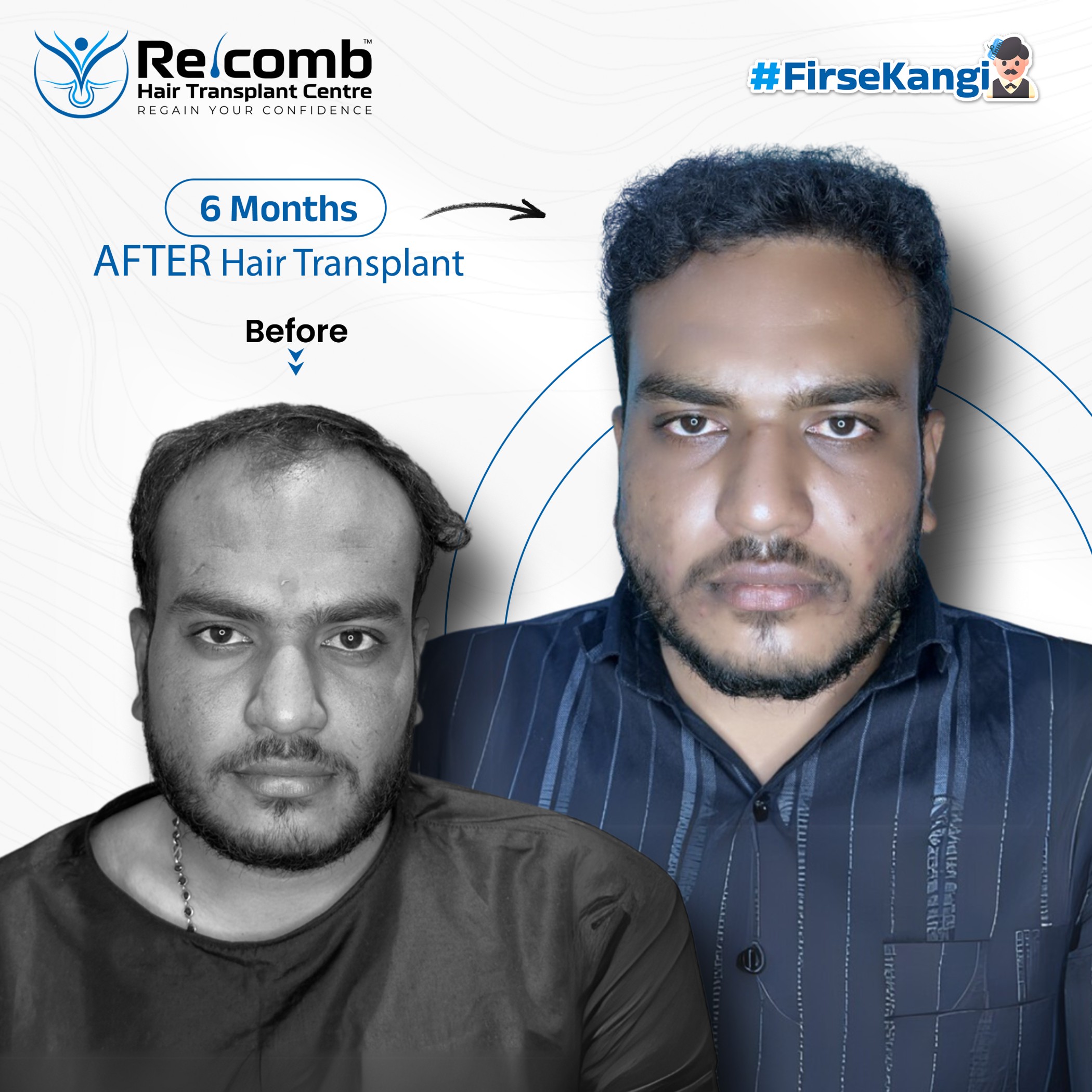 MayurBhai_Before_After_Post