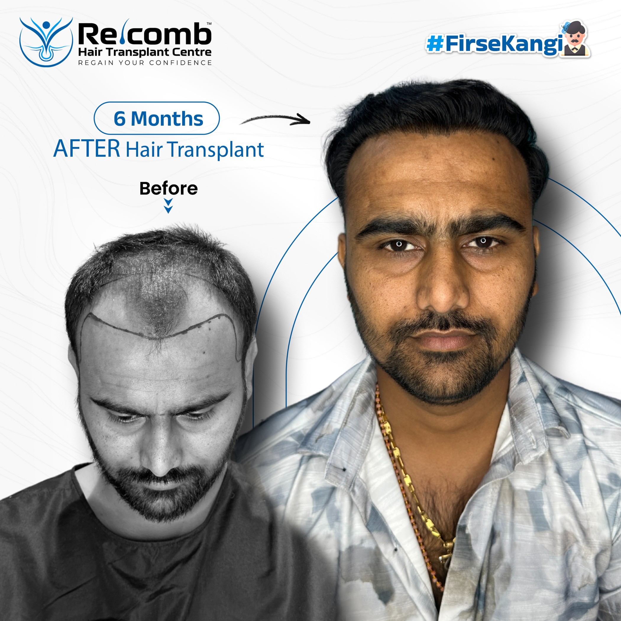 NanjiBhai_Recomb_Before_After_Post
