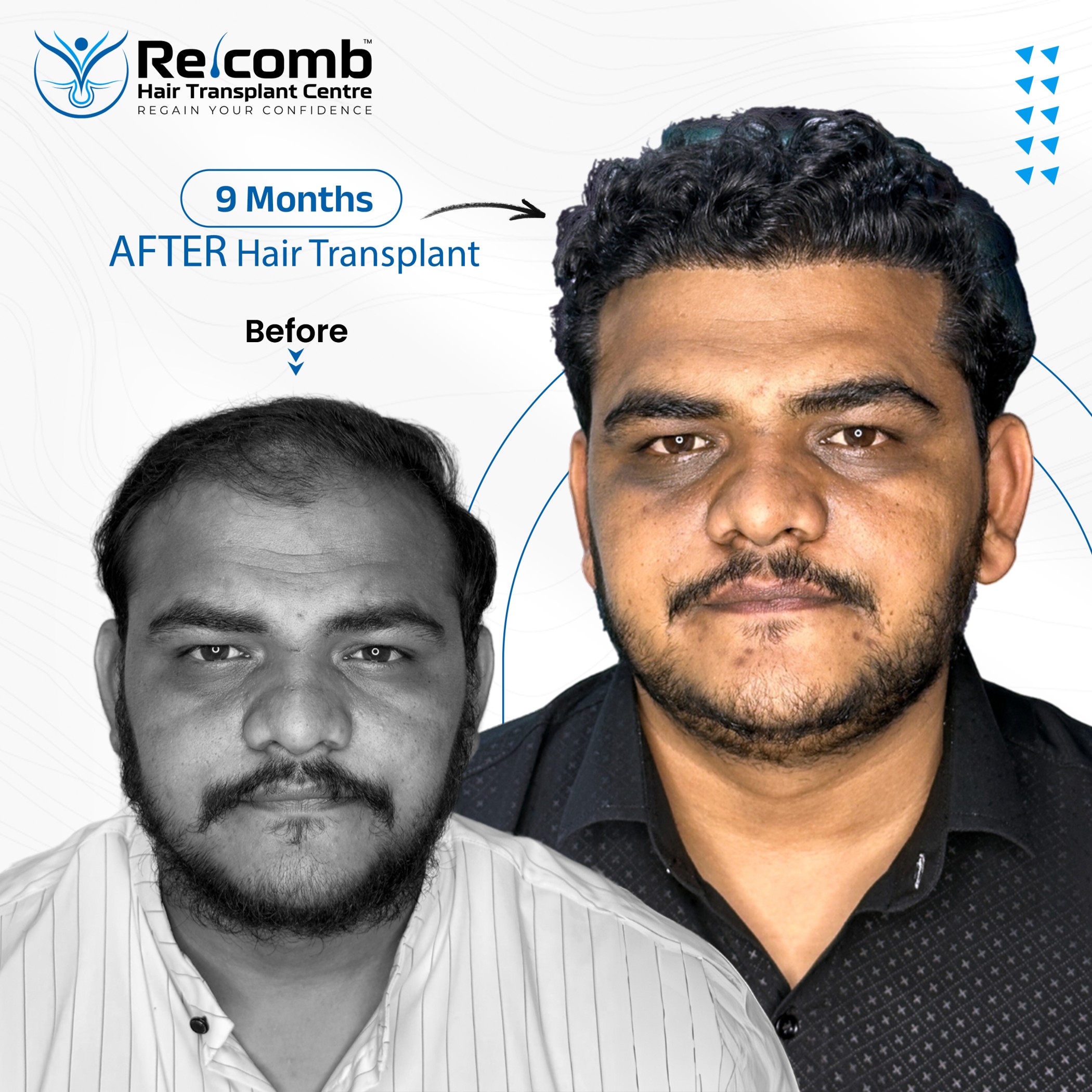 Recomb_Before_After_Post2