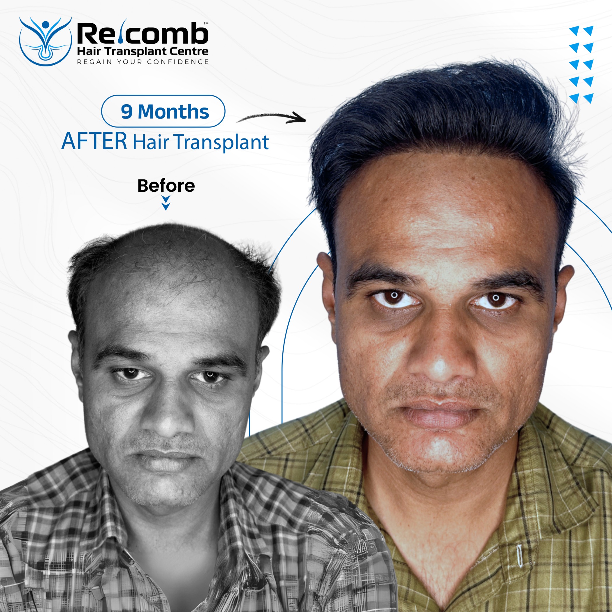 Recomb_Before_After_Post__1_