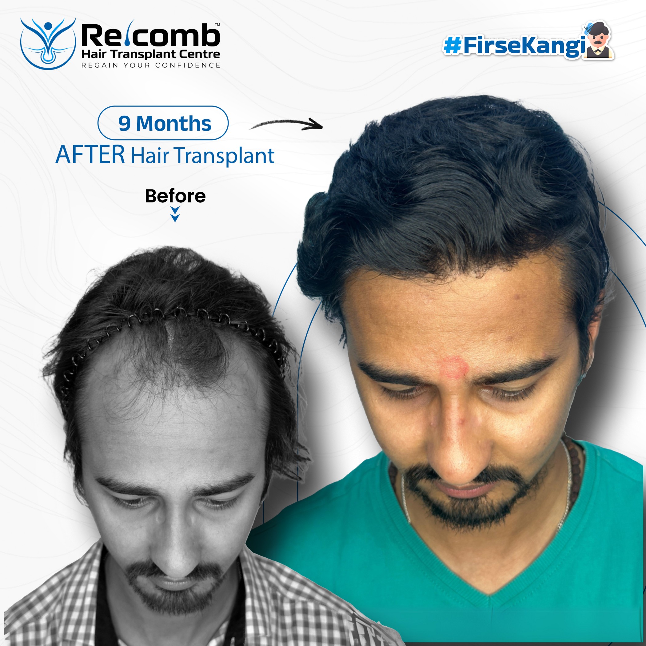 SIDDHARTH_SONI_Recomb_Before_After_Post