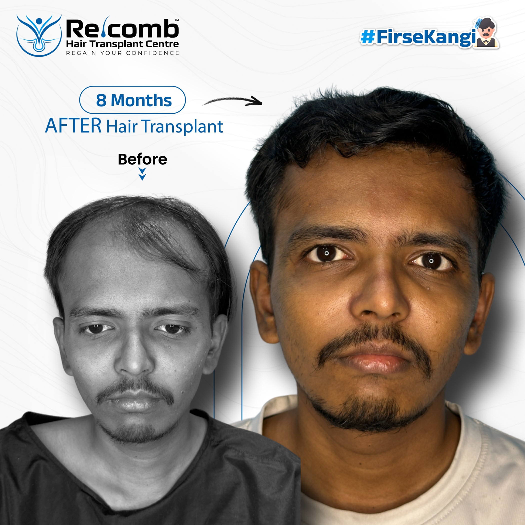 aakash_Recomb_Before_After_Post