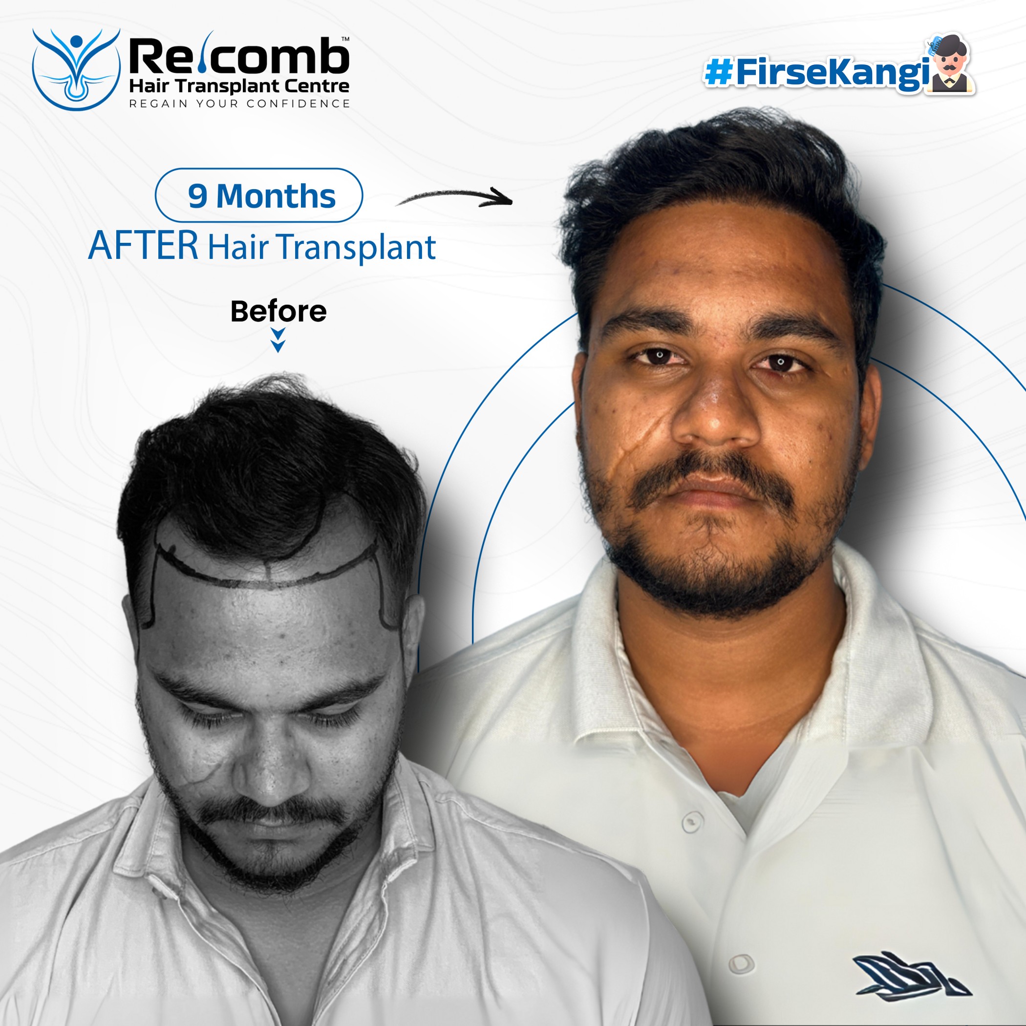 ankit_Before_After_Post